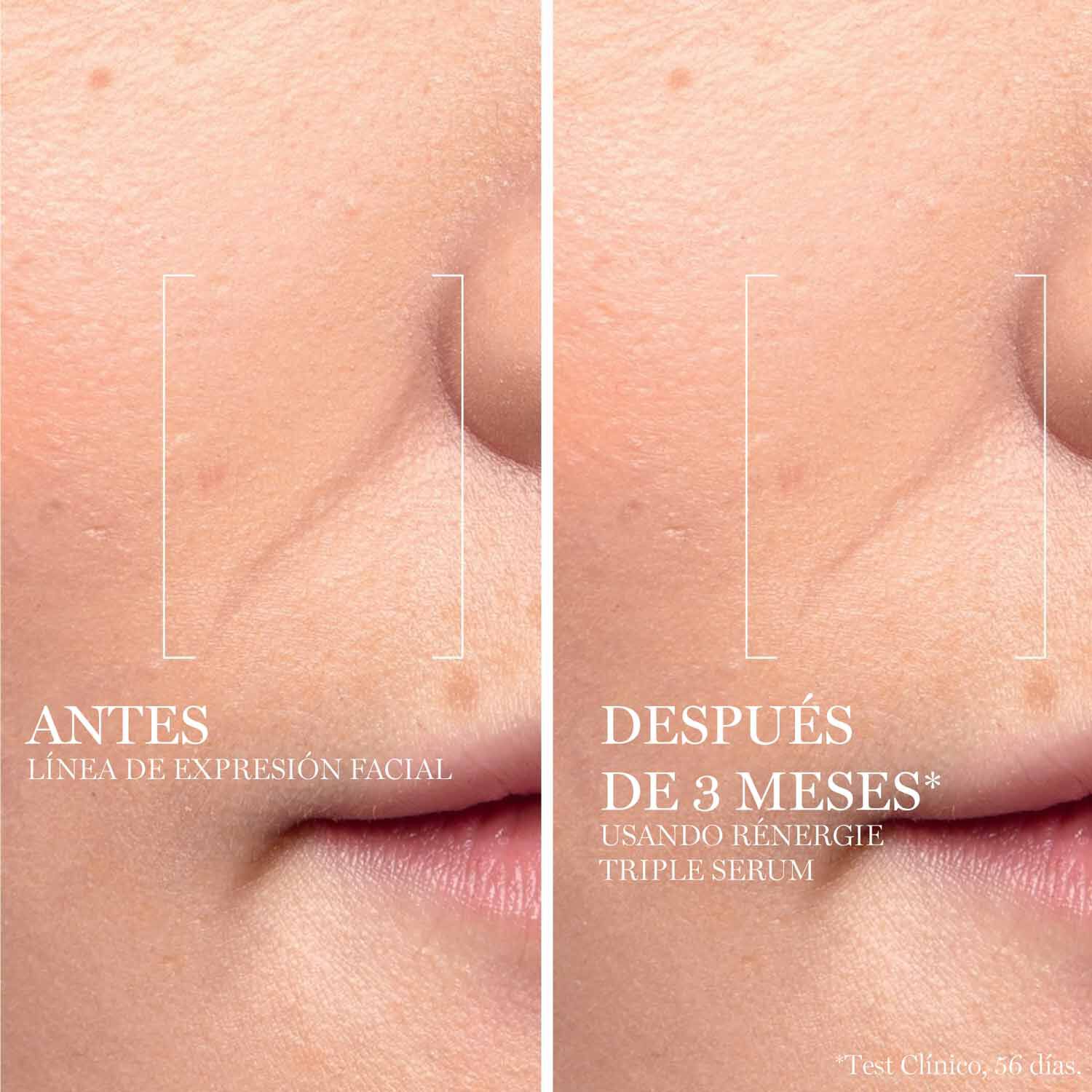 RENERGIE H.C.F. TRIPLE SERUM